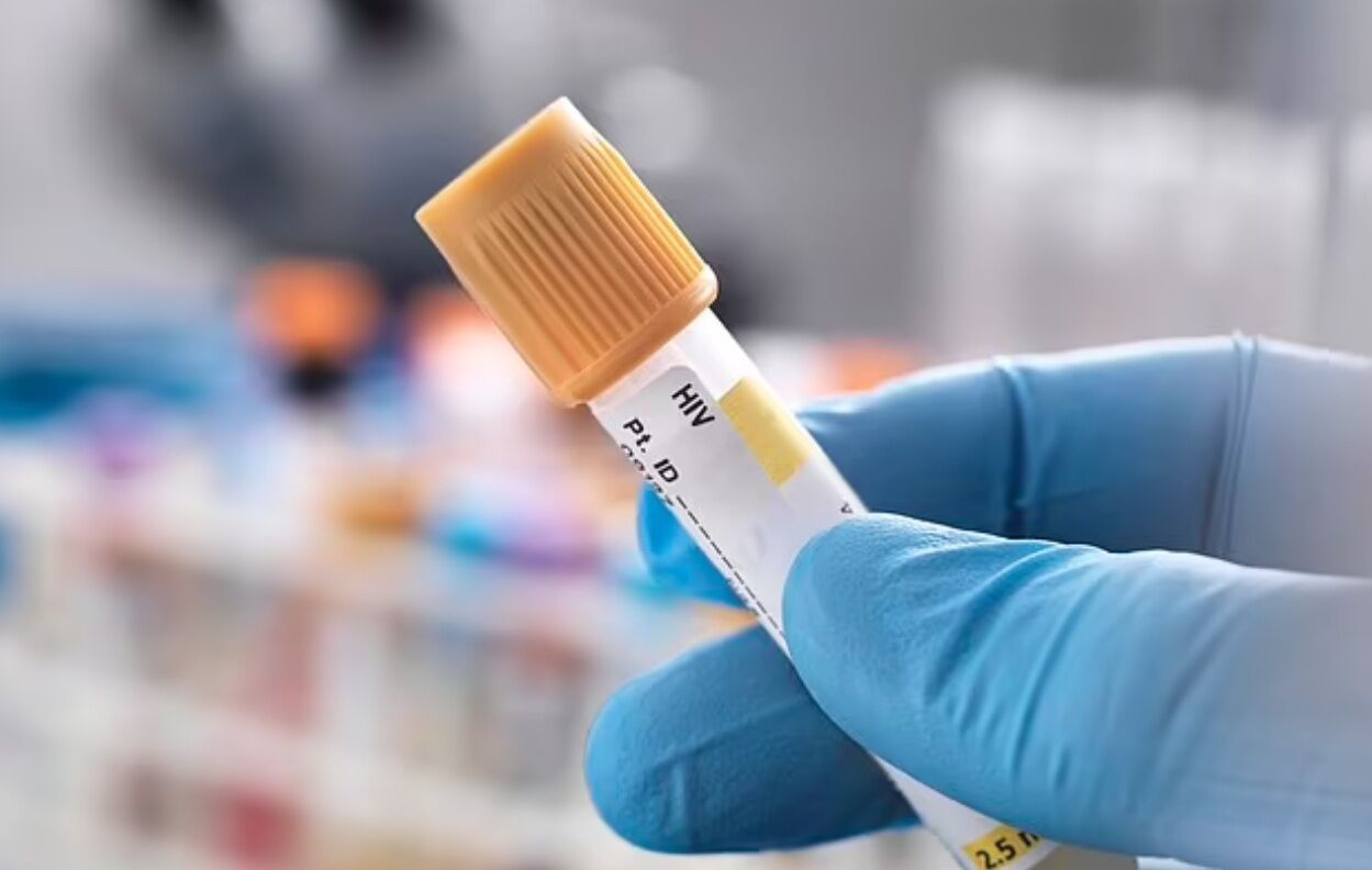 درمان ابولا و ایدز با استفاده از ژن میمون