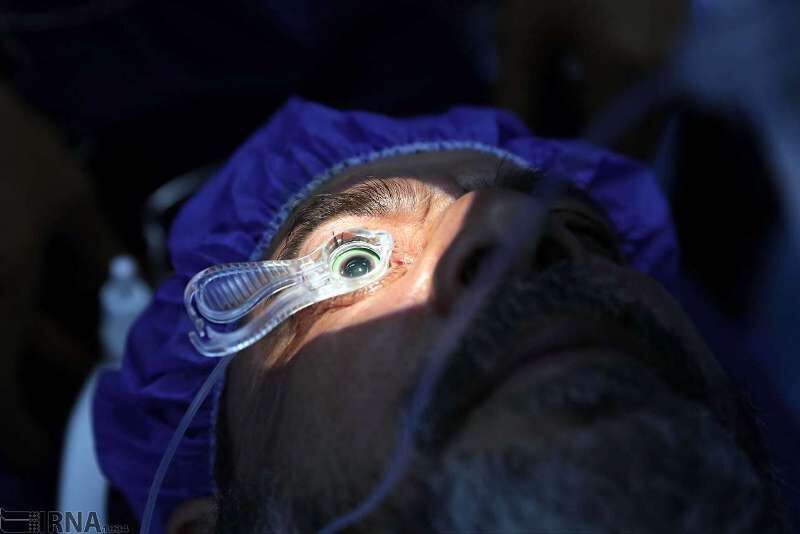 تولید لنزهای تماسی جدید برای بیماران عیوب انکساری