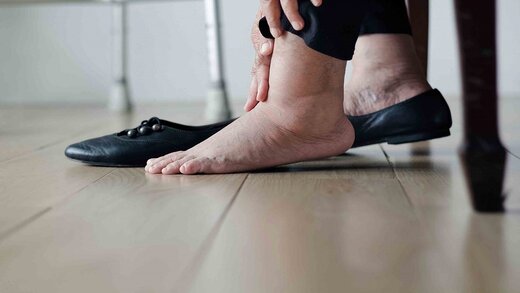 ۵ دلیل مهم که باعث می‌شود پاها ورم کنند