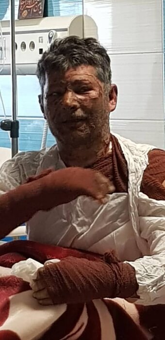 حمله کوکتل مولوتوفی مالکان چاه غیرمجاز به ماموران اداره آب/ راننده لودر سوخت/عکس