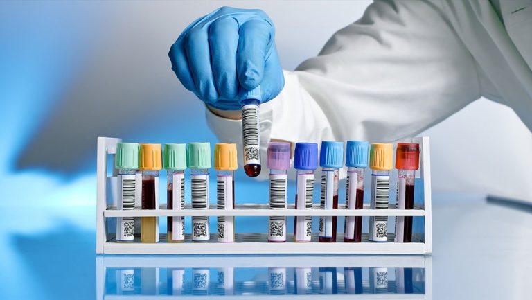 خدمات آزمایشگاهی از پوشش بیمه خارج شد؟