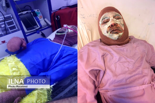سوختن یک دانشجو و کارشناس آزمایشگاه در پردیس دانشگاه تهران/ عکس