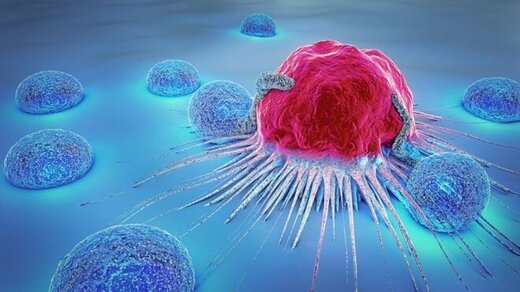راه‌های پیشگیری از سرطان شایع زنان چیست؟