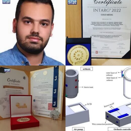 ۴ محصول در عرصه بهداشت و درمان اختراع شد