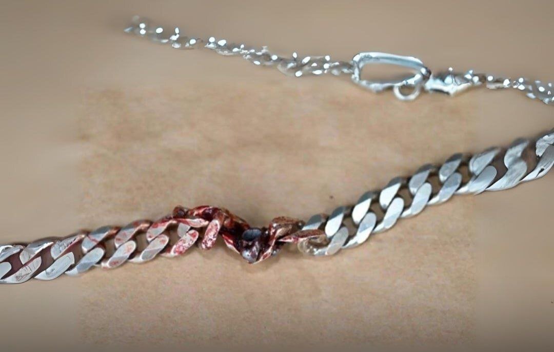 گردنبند تقلبی جان مرد را نجات داد/ عکس