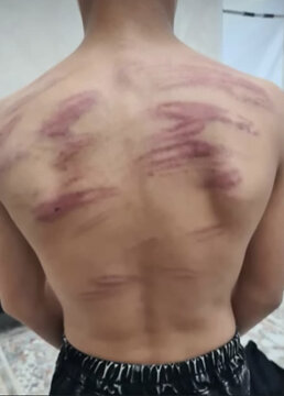 بیانیه آموزش و پرورش ناحیه دو سنندج در خصوص تنبیه بدنی دانش آموزان دبستان راشدین روستای کرجو