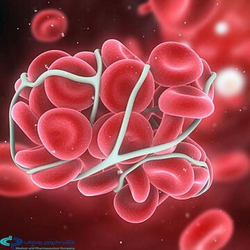 شناسایی و درمان ۹ بیمار مبتلا به SMA در استان و رایگان شدن کامل هزینه داروی خوراکی برای آنان