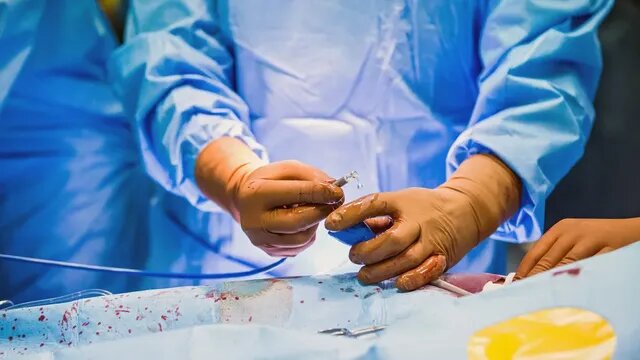 کوچکترین قلب مصنوعی جهان، جان پسر ۷ ساله چینی را نجات داد