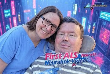 معجزه تراشه نورالینک در مغز اولین بیمار مبتلا به «ALS»