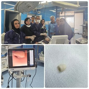 نجات معجزهآسای شیرخوار ۱۸ ماهه سمنانی از خفگی با بادام زمینی