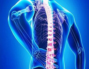 گام نوین دانشگاه علوم پزشکی شهرکرد در پیشگیری از کمردرد