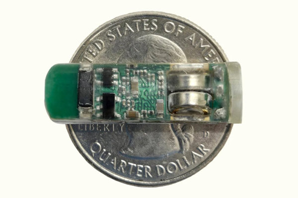 انقلابی در تشخیص بیماری‌های گوارشی بدون روش‌های تهاجمی