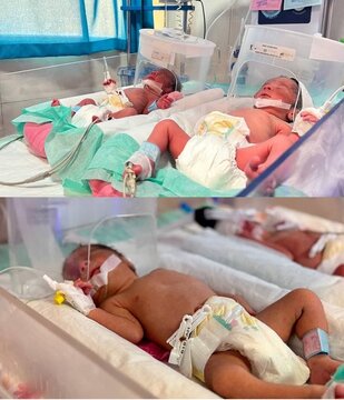 تولد سه‌قلوهای سالم با روش IVF در بیمارستان بعثت سنندج؛ موفقیت بزرگ تیم درمانی دانشگاه