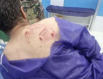 جزییات حمله خرس به یک جوان جیرفتی