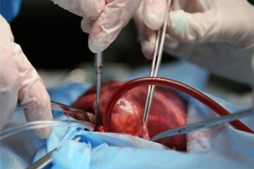 مشهد قطب پیوند قلب شرق کشور شد