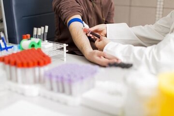 هپاتیت؛ اپیدمی خاموش با پیامدهای ویرانگر