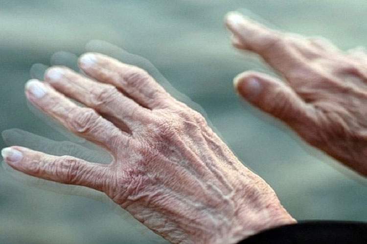 پارکینسون با مصرف غذاهای فوق فرآوری شده مرتبط است