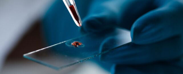 کشف یک گروه خونی منحصر به فرد: تنها فرد سازگار با خون خود در جهان!