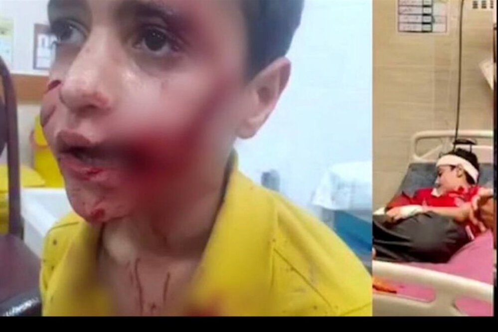 از امیرعلی تا مهسا؛ قربانیان فراموششده سگهای بیصاحب در ایران/ «شخصی با نفوذ قابل توجه از حامیان سگهای ولگرد است»/ مرگ ۱۸ کودک طی چهار سال