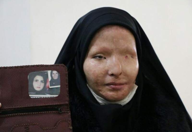 سیما افشاری کیست؟/ عکس