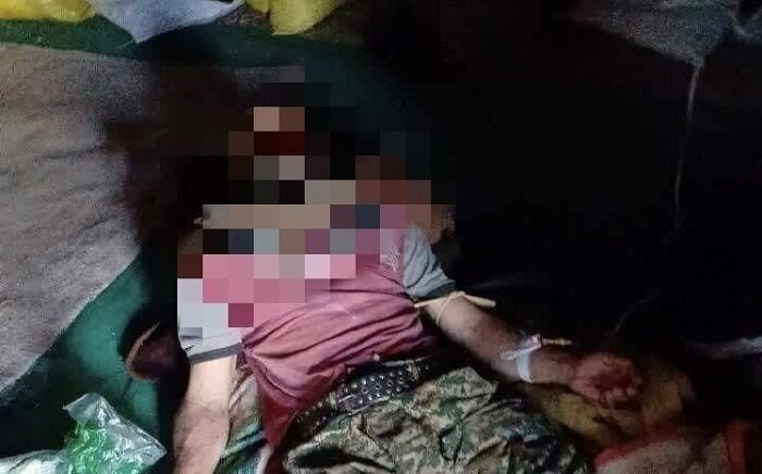 حمله خرس به نوجوان ۱۶ ساله/ عکس