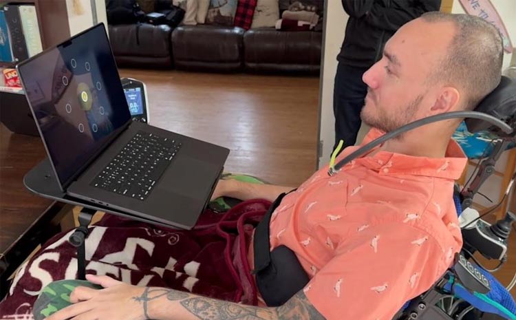 نگرانیهای اخلاقی ایمپلنت مغزی؛ از داستانهای علمی تخیلی تا واقعیت