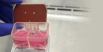 «چیپ معجزهگر» سرطان؛ فناوری جدید پیشبینی میکند درمان جواب میدهد یا نه