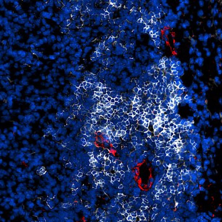 تحول در روند درمان سرطان با تبدیل «تومورهای سرد» به «تومورهای داغ»