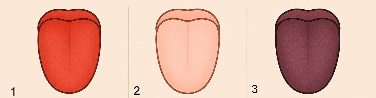 تشخیص انواع بیماری‌ها با بررسی زبان/ رد دندان روی زبان نشانه چیست؟