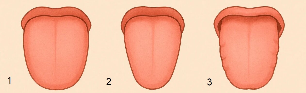 تشخیص انواع بیماری‌ها با بررسی زبان/ رد دندان روی زبان نشانه چیست؟