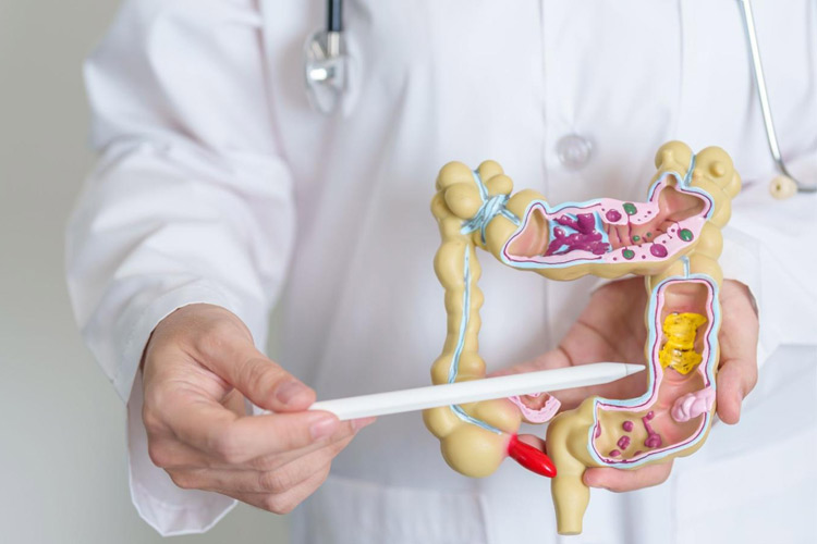 هفت نشانه اولیه سرطان روده بزرگ