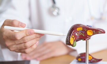 ۶ مکمل‌ و ویتامین برای کنترل بیماری کبد چرب