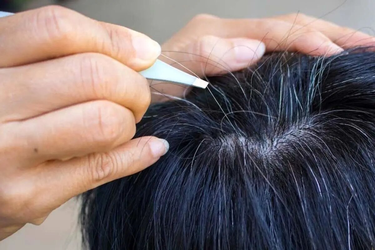 آیا میتوان جلوی سفید شدن موها را گرفت؟/ دلیل سفیدی مو در نواحی شقیقهها چیست؟/ چه دارو و مکملی اثر قطعی بر رفع سفیدی مو دارد؟