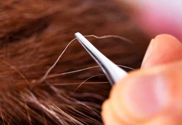 آیا میتوان جلوی سفید شدن موها را گرفت؟/ دلیل سفیدی مو در نواحی شقیقهها چیست؟/ چه دارو و مکملی اثر قطعی بر رفع سفیدی مو دارد؟