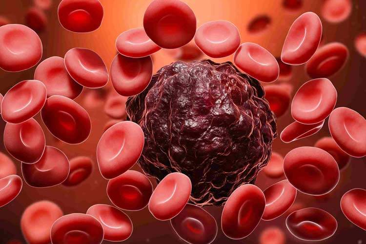 روش جدید نوردرمانی در نیم ساعت، ۹۰ درصد از سلولهای سرطانی را از بین میبرد