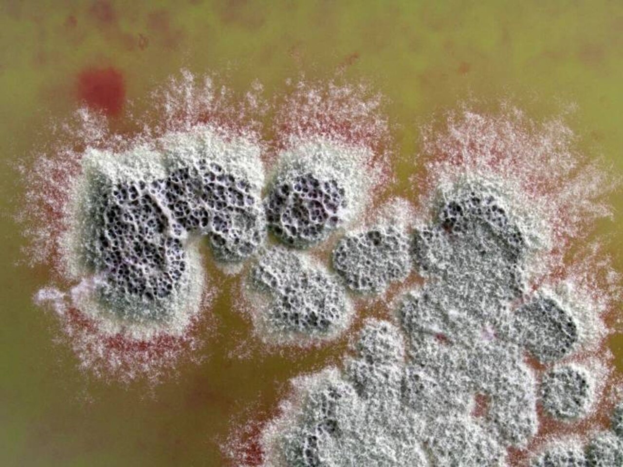 کلنی باکتری Streptomyces coelicolor