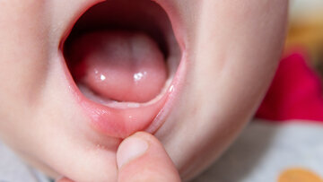 کشف نشانه‌ای عجیب از پیری زودهنگام در کودکان