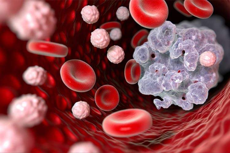 ۴ نشانه عجیب سرطان که هرگز نباید نادیده بگیرید