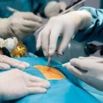 فریب لاغری با بستن رگ اشتها را نخورید؛ این افراد باید با اسلیو و بای‌پس خداحافظی کنند