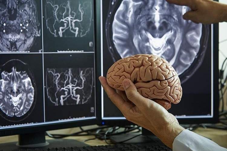 مغز انسان در چهار مقطع کلیدی عمر، بازسازماندهی میشود