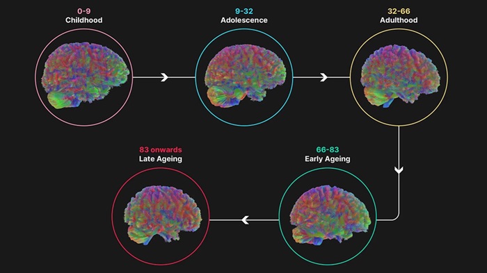 مغز انسان در چهار مقطع کلیدی عمر، بازسازماندهی میشود