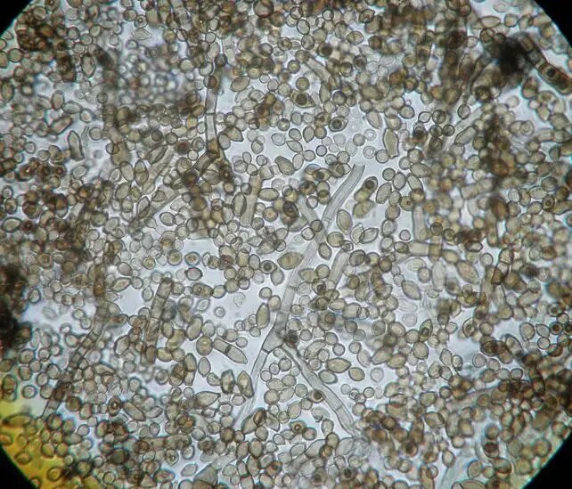 موجودی عجیب که خوراکش رادیواکتیو است! / هیولای چرنوبیل