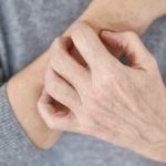 این نشانهها یعنی بیماری پوستی