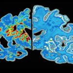 «ساعت آلزایمر» ساخته شد