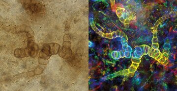 کشف باکتری ۵ هزار ساله مقاوم به آنتیبیوتیک